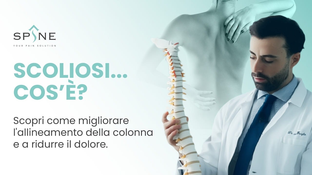 Scoliosi: cos’è e come trattarla con l’osteopatia